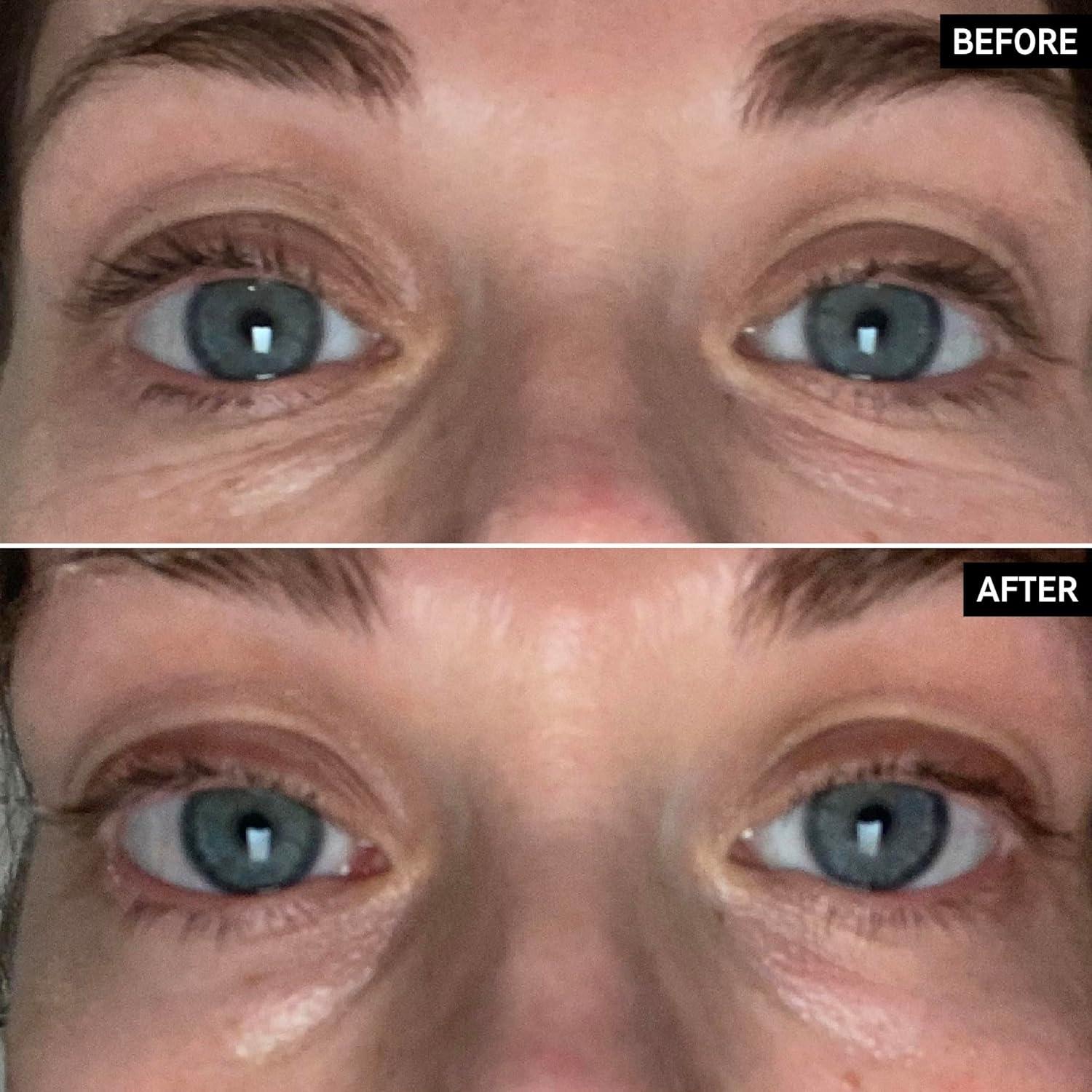 image:imageThe INKEY List BrightenI Eye Cream UnderEye Cream Helps Reduce Appearance of Dark Circles and Boost Skins Glow Makeup UnderEye Primer 050 fl oz