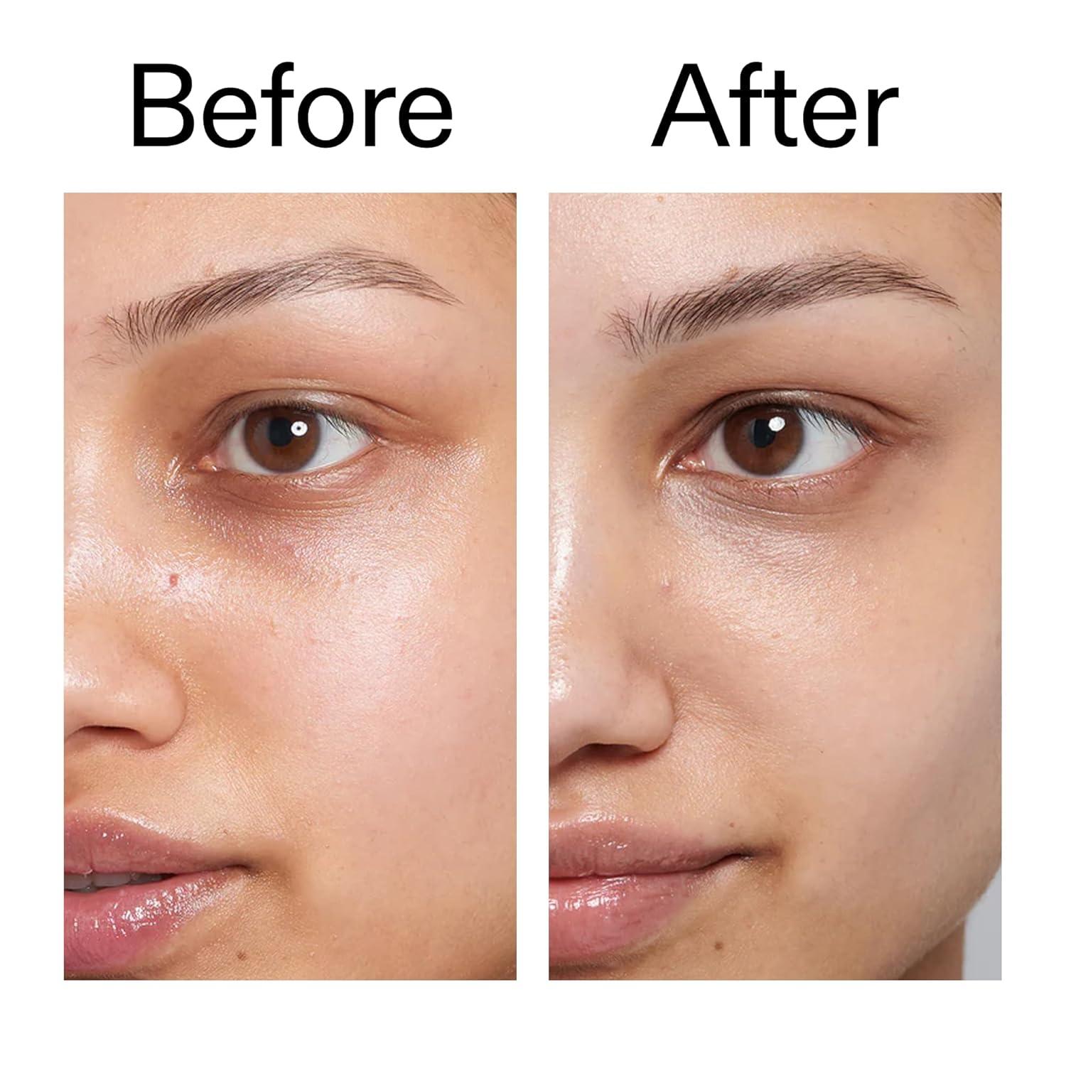 image:imageThe INKEY List Caffeine Eye Cream Duo Reduce Eye Puffiness and Dark Circle Blur Fine Lines 05 fl oz 2 Pack05 Fl Oz Pack of 1