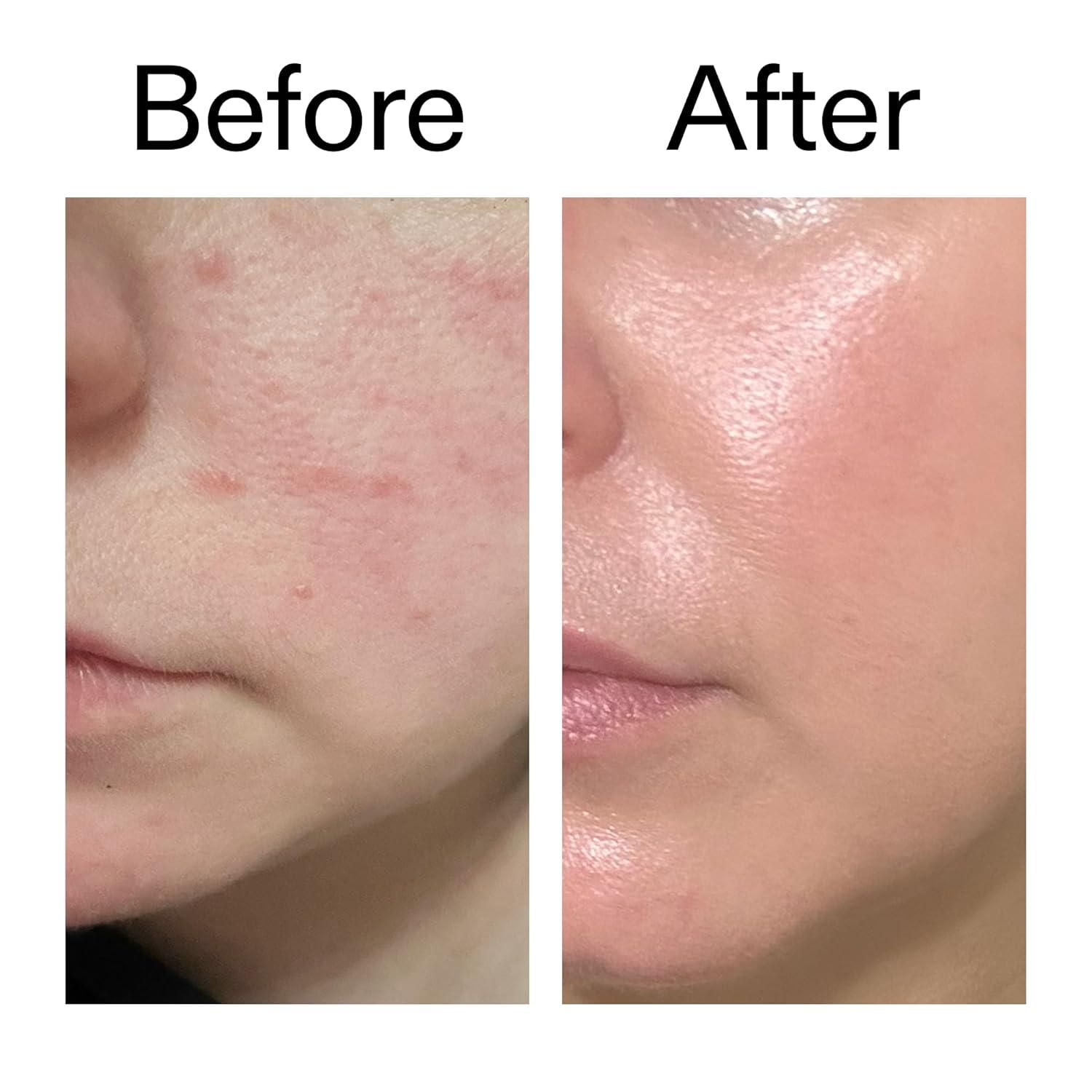 image:imageThe INKEY List Exosome HydroGlow Complex Enhances Skin Radiance Rejuvanating Skincare Advanced Hydration Suitable For All Skin Types