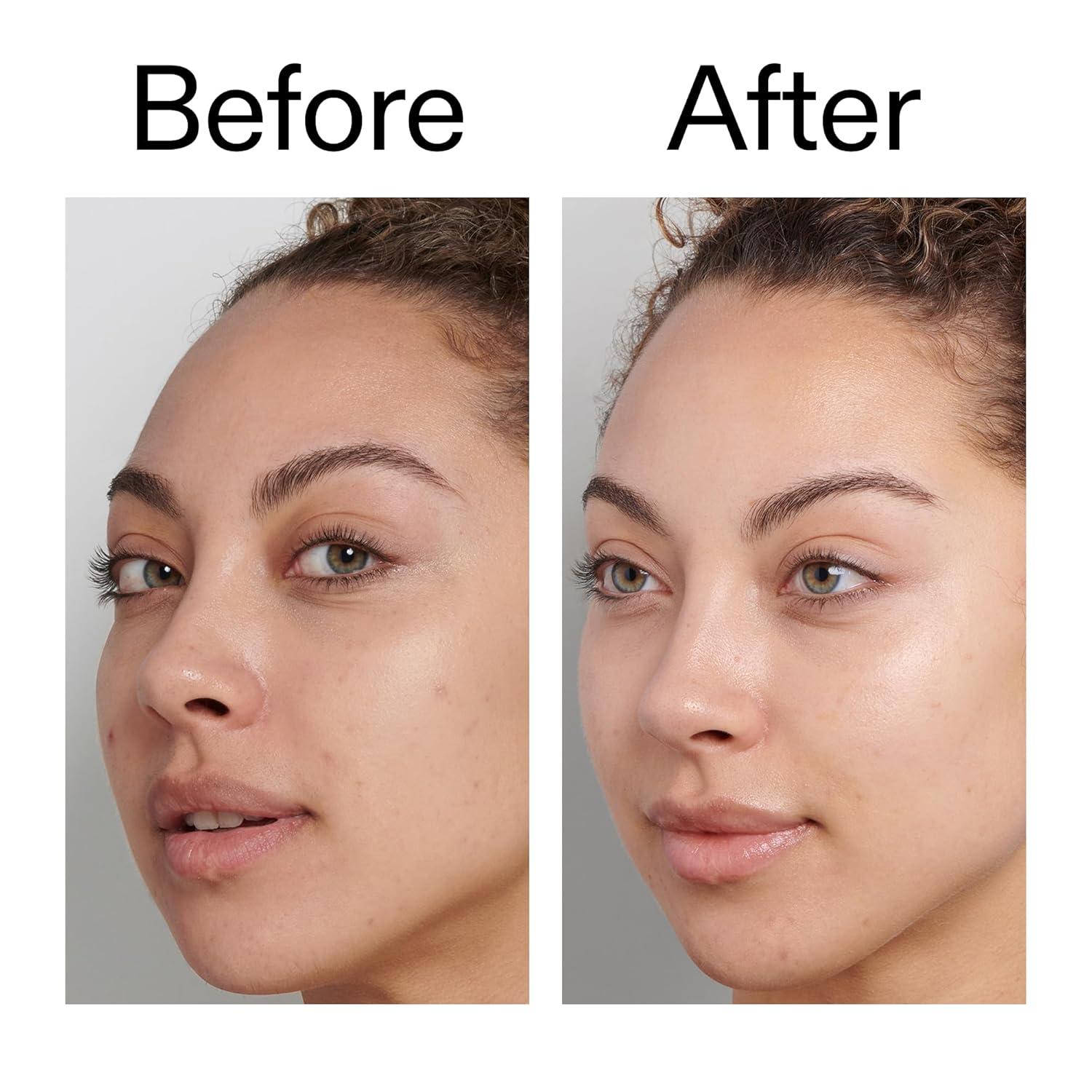 image:imageThe INKEY List Fulvic Acid Brightening Cleanser 5 Fl Oz Removes Makeup For a Healthy Looking Complexion Fragrance Free Suitable For All Skin Types