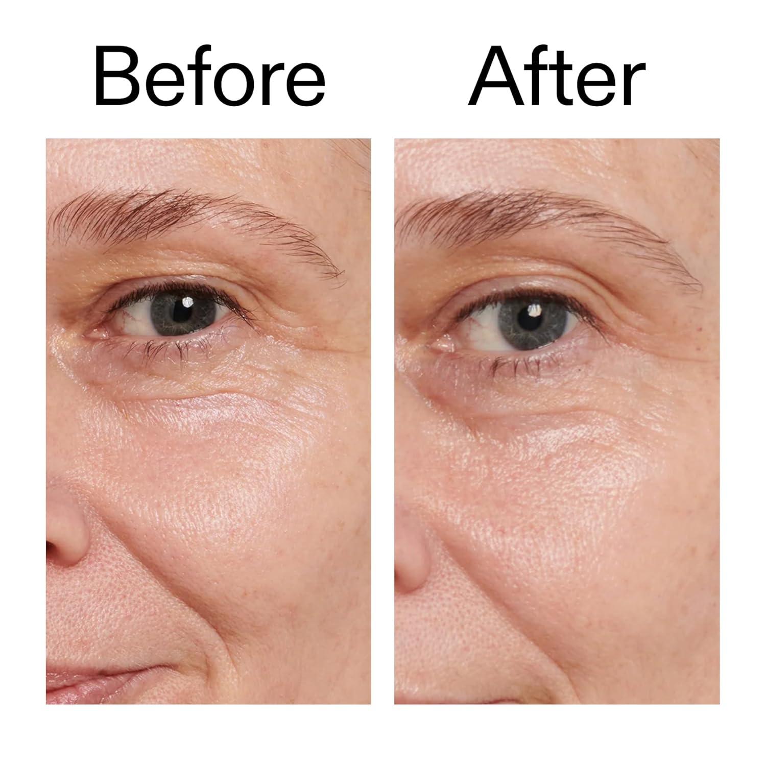 image:imageThe INKEY List Retinol Eye Cream 05 Fl Oz Reduce Wrinkles and Fine Lines Night Cream Vegan Friendly Suitable For All Skin Types