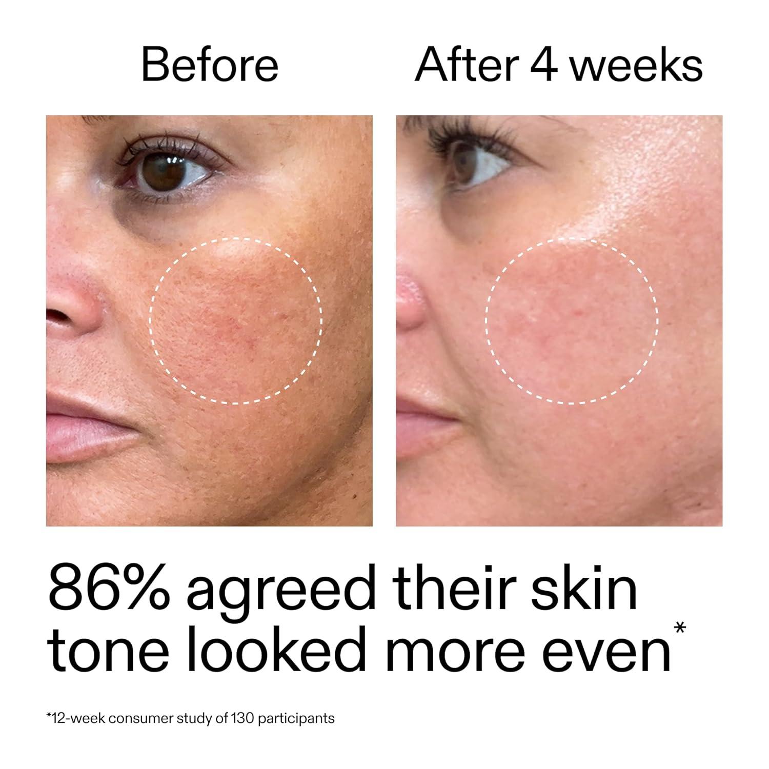 image:imageThe INKEY List Starter Dual Retinol Serum 1 Fl Oz 05 Amisol Trio amp 02 Symrelief Gentle Skin Renewal Smooths Fine Lines Hydration amp Barrier Protection Suitable for Sensitive Skin