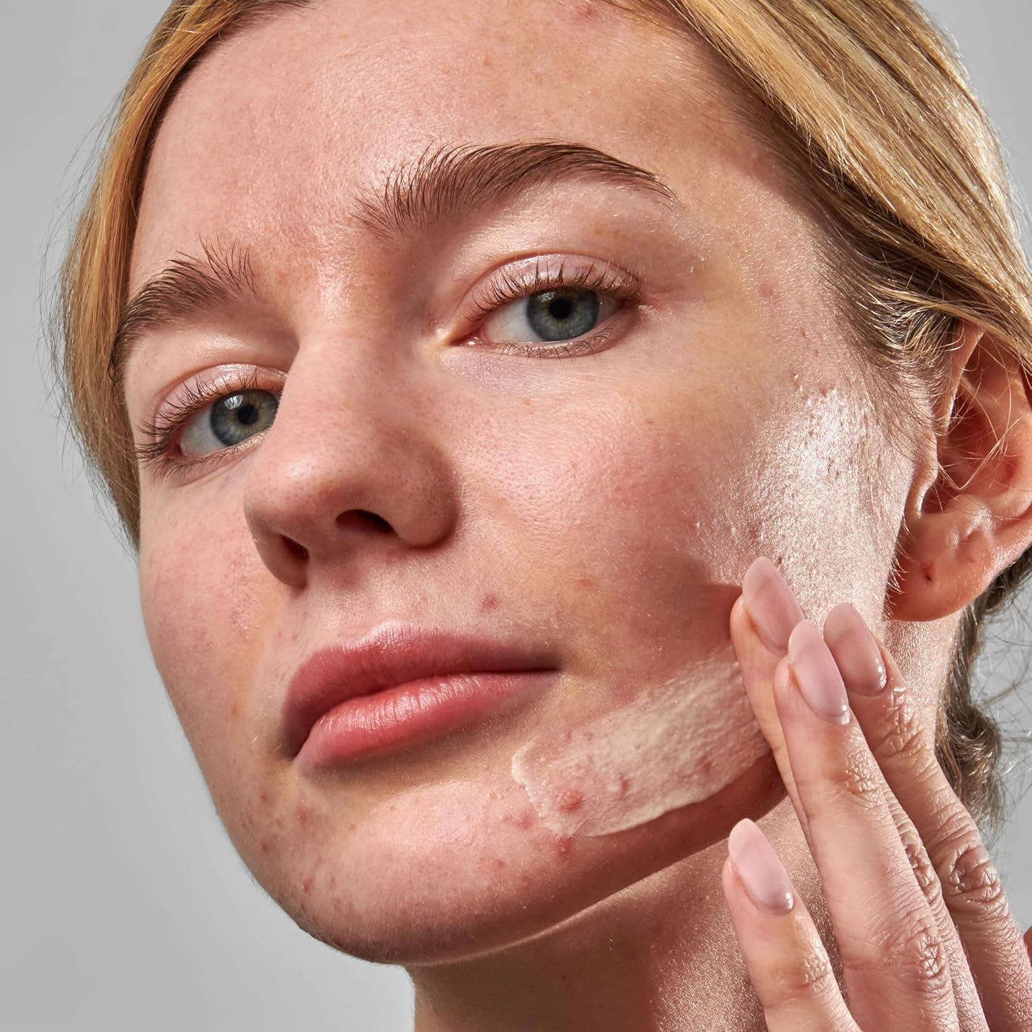 image:imageThe INKEY List SuperSolutions Novoretin 2 Moisturizer Skin Clearing Moisturizer to Reduce Blemishes and Breakouts While You Sleep NonComedogenic 169 fl oz