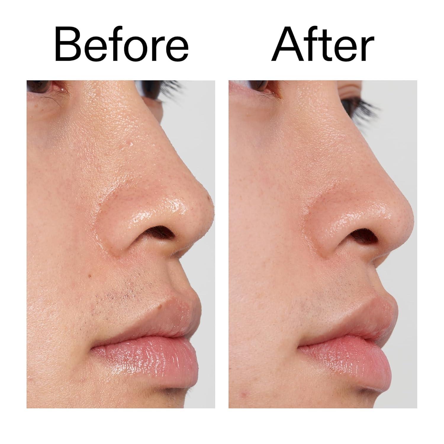 image:imageThe Inkey List PHA Toner 100ml Locks in Moisture Improves Skin Texture Fragrance Free Suitable for All Skin Types
