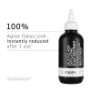 The INKEY List Salicylic Acid Exfoliating Scalp Treatment 5 Fl Oz, Hydrating Scalp Oil, Moisturizing Scalp Scrub, Suitable For All Hair Types
