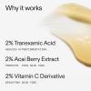 The INKEY List Tranexamic Acid Serum, Helps Reduce Appearance of Skin Discoloration, Dark Spots and Uneven Patches, Healthy-Looking Skin Tone, 1 fl oz