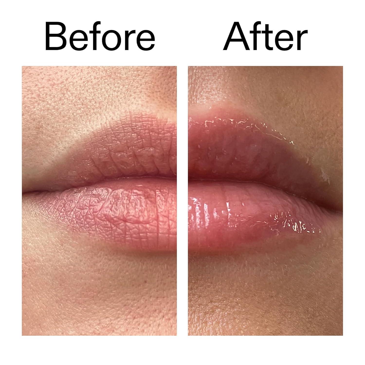 image:imageThe INKEY List Tripeptide Plumping Lip Balm 10ml Clinically Proven Plumping Tinted Lip Care Hydrates Dry Cracked Lips Vegan amp Cruelty Free Mocha TintOff White