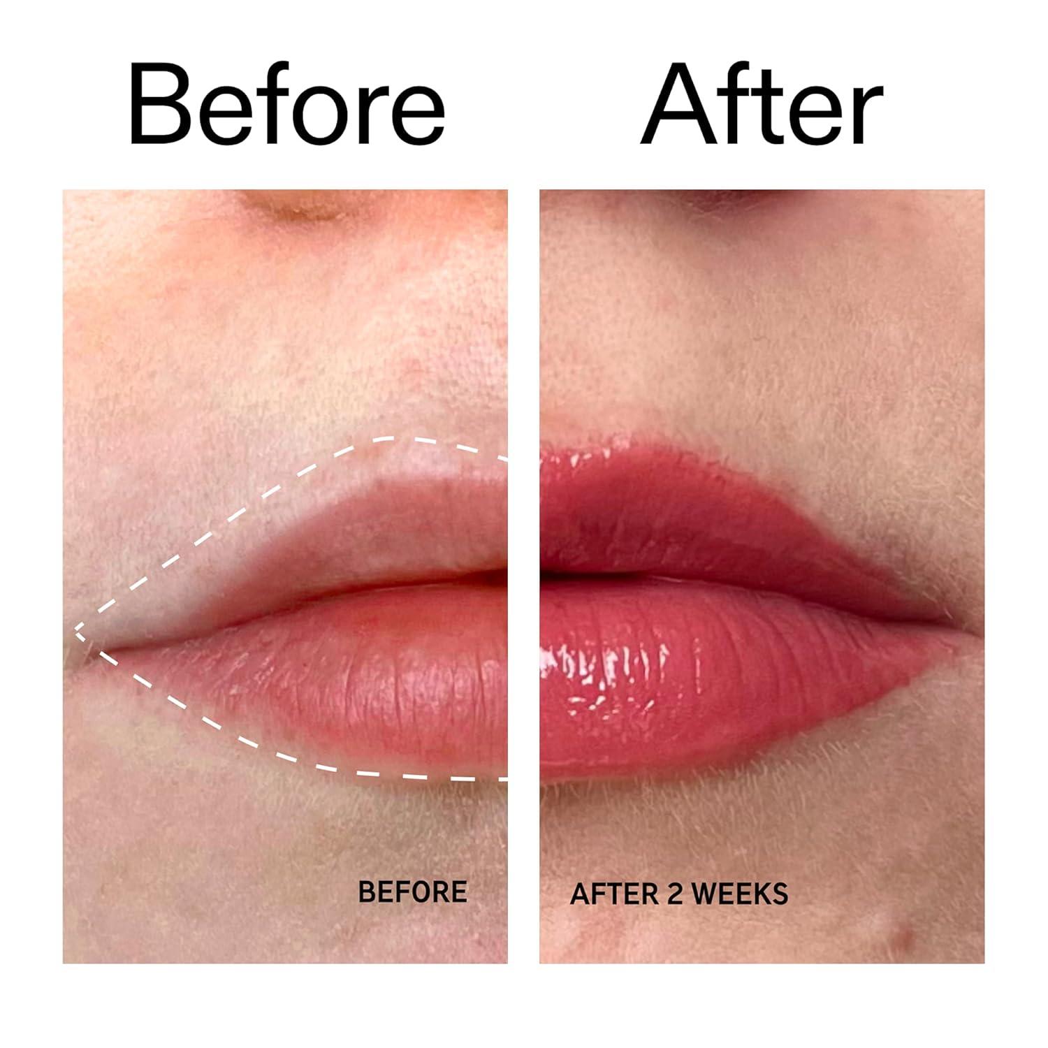 image:imageThe INKEY List Tripeptide Plumping Lip Balm 10ml Clinically Proven Plumping Tinted Lip Care Hydrates Dry Cracked Lips Vegan amp Cruelty Free Mocha TintBerry
